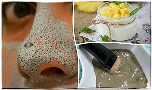 get rid of blackheads