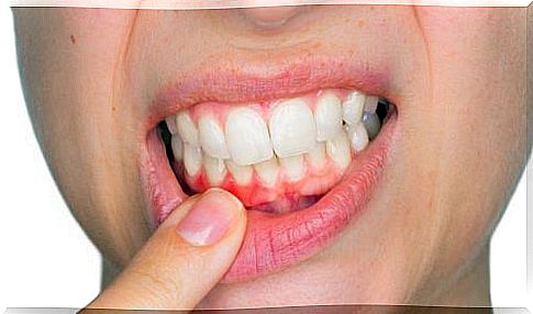 symptoms of dental inflammation: tooth decay