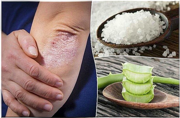 Expel your sponge with these 5 natural treatments