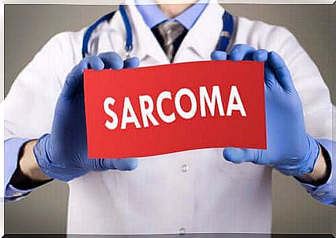 Different sarcomas and their features