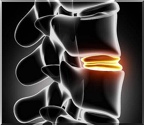 There is a difference between a bulge in the septum and normal back pain.