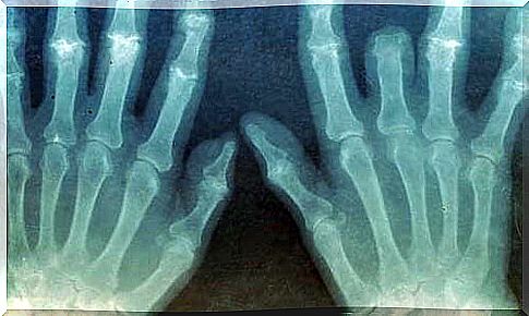 x-ray image of hands