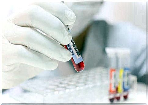 Hypocalcemia is diagnosed by a blood test