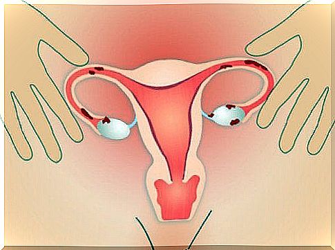 blood clots due to endometriosis