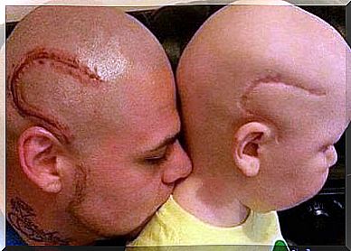 “Now we look the same,” Dad tattooed his son’s cancer surgery horn