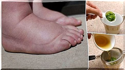 The best help for swollen feet is parsley