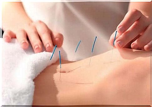 benefits of acupuncture for humans